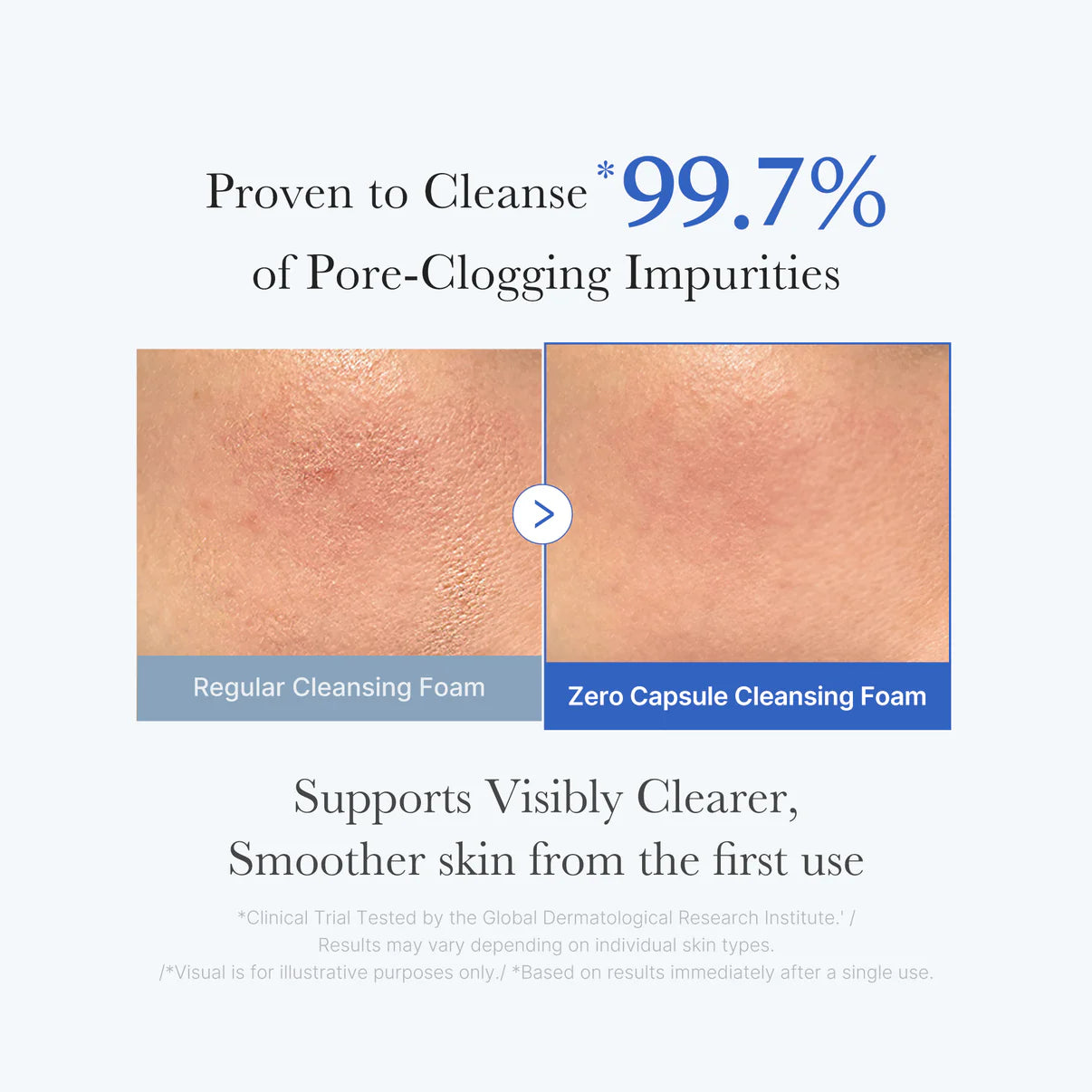 medicube Zero Pore SA Capsule Cleansing Foam