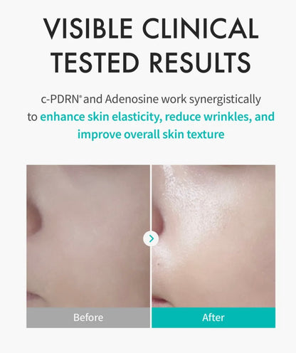 REJURAN Turnover Mask