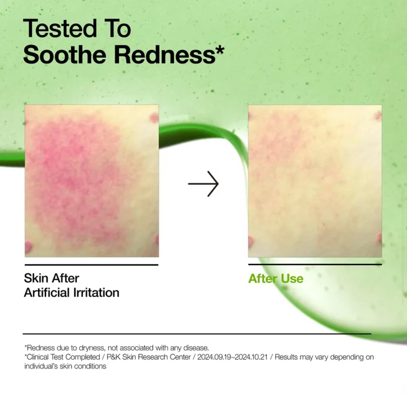 Anua Azelaic Acid 10 Hyaluron Redness Soothing Serum