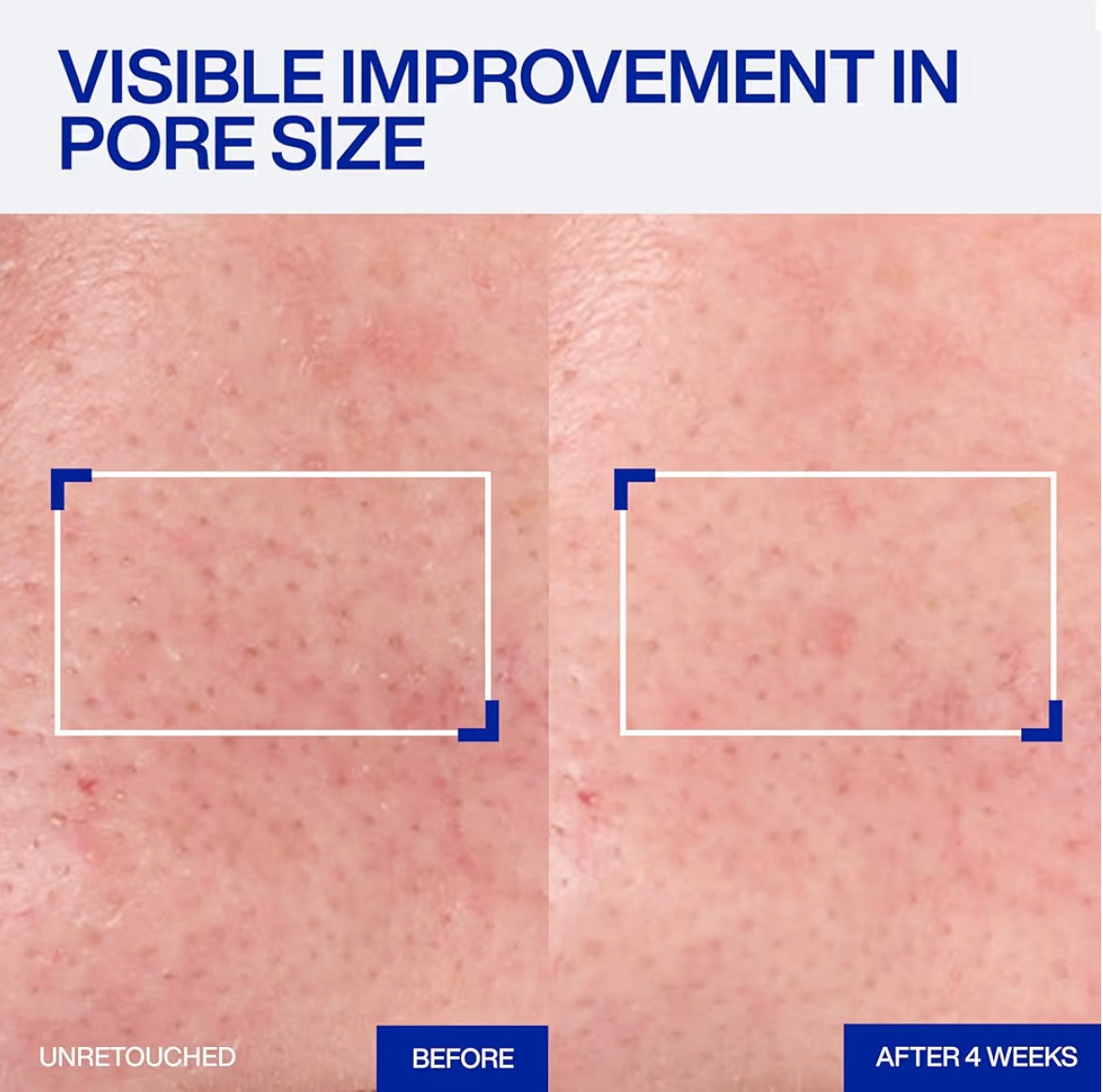 IOPE Retinol Super Bounce Serum RX™ 1%