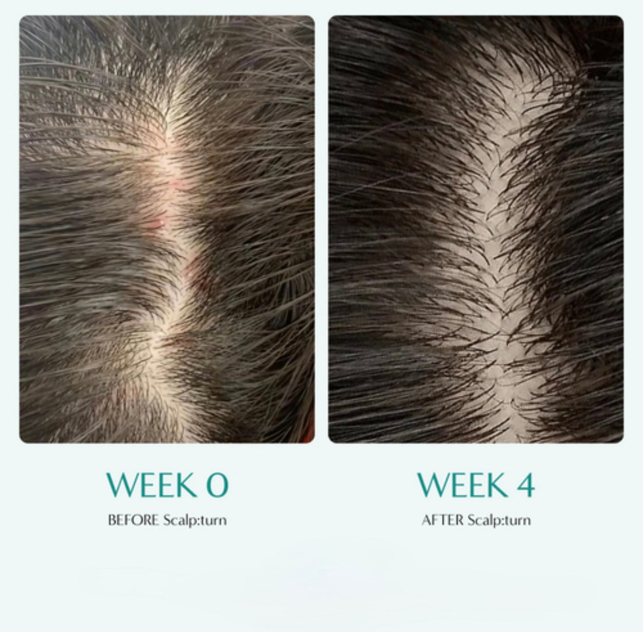 Lilyeve Scalp:Turn Cica PDRN Brush Ampoule Mini