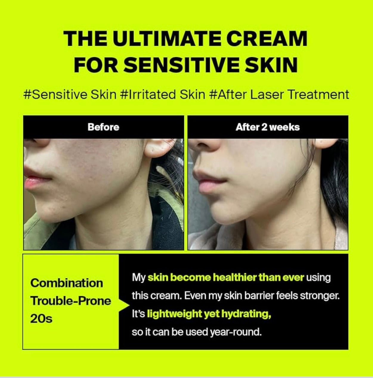 PURCELL Pixcell Biom After Laser Rebooting Cream